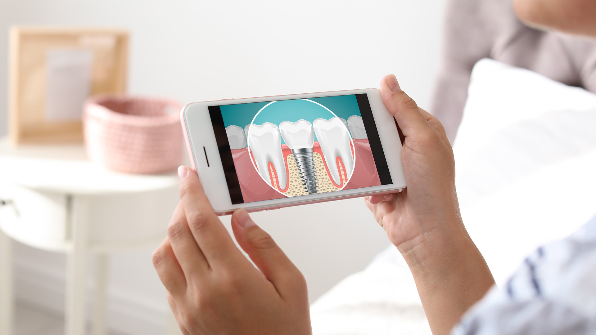 A person holding a smartphone with an image of a tooth on the screen, showcasing dental implant technology.