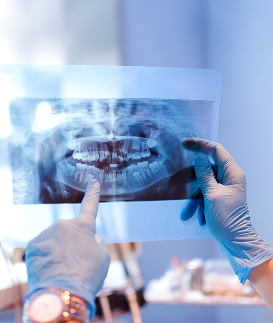 An image of a dental professional holding up an X-ray film with a toothy smile, showcasing a patient s dental condition.