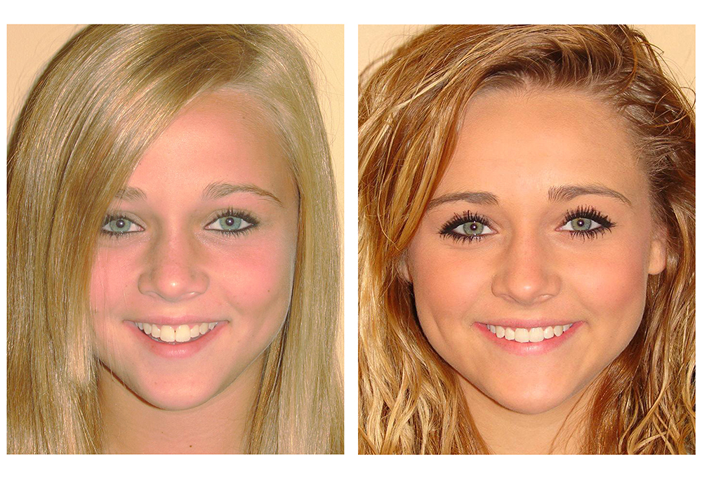 Redwood Family Dental