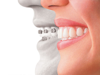 The image is a composite of two different photographs, one showing a smiling person s face and the other depicting an open mouth with teeth.