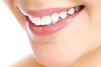 The image displays a close-up of a person s profile, showcasing a smile with braces and teeth whitening treatment.