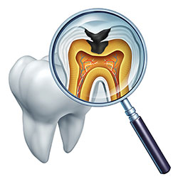 The image shows a magnified view of a human tooth with the inside structure visible, including pulp and root canals, viewed through a magnifying glass.