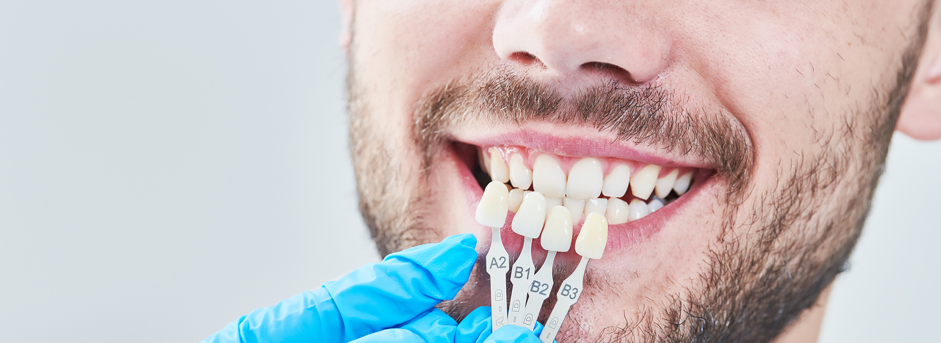 A man with a toothy smile is shown from the waist up, wearing white gloves and holding a dental implant in his mouth.